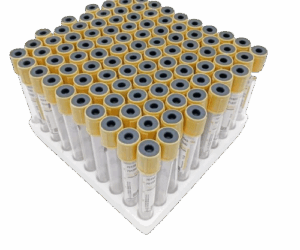 Medical Yellow top vacutainers.