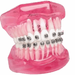 Medical Dental orthodontic braces.